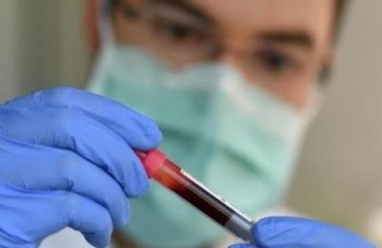 Đức: Sau 4 ngày tăng liên tục, số ca nhiễm mới và qua đời đã giảm đáng kể
