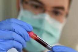 Đức: Sau 4 ngày tăng liên tục, số ca nhiễm mới và qua đời đã giảm đáng kể